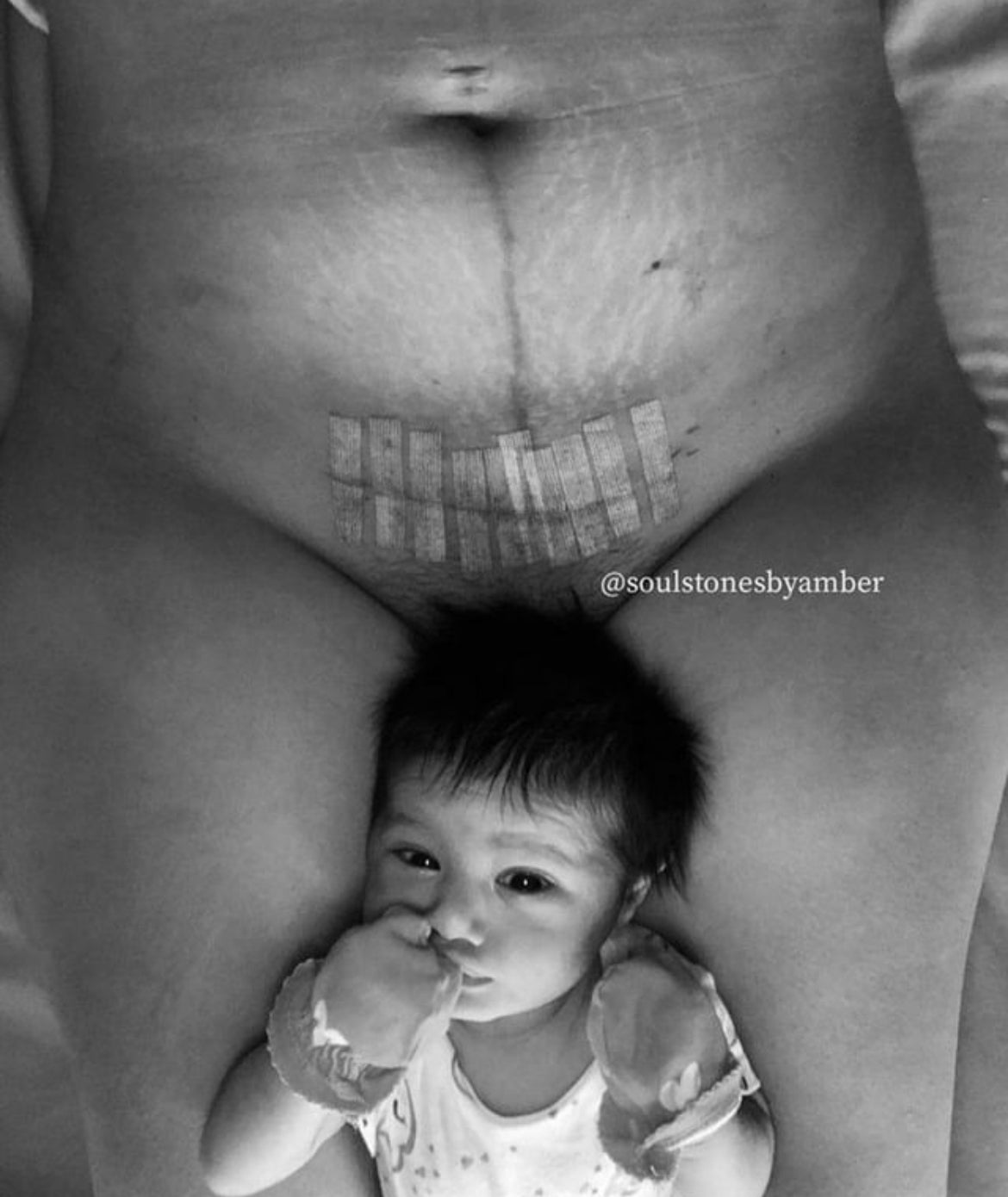 C-section mum with stitches and new baby