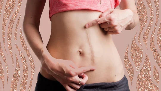 Scar Tissue Massage: When & How to Massage Scar Tissue Post-Surgery