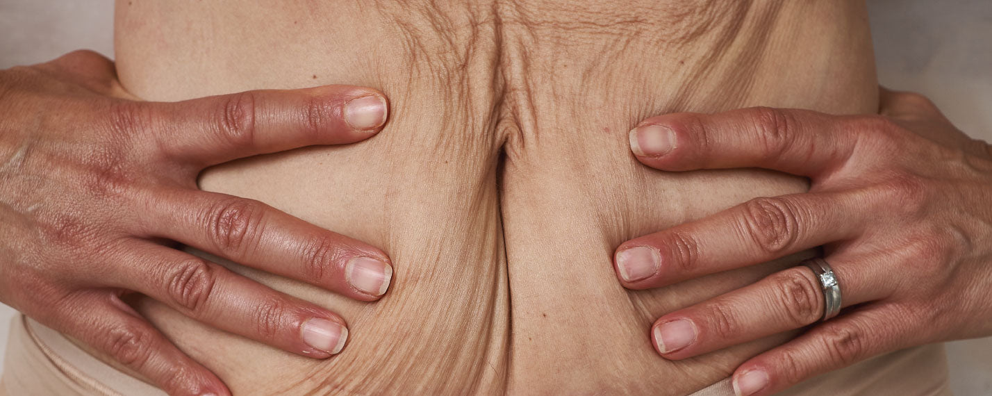Menopause