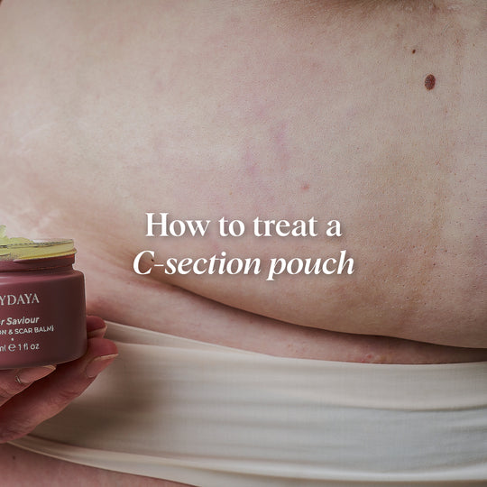 What Is A C-Section Pouch & Can You Treat It?