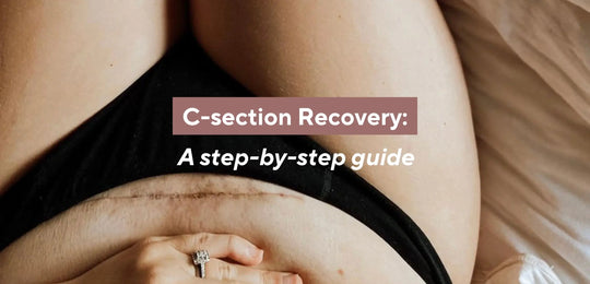 C-section Scar Recovery: A Step-by-Step Guide