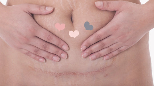 How to massage your c-section scar & learn to love your stomach