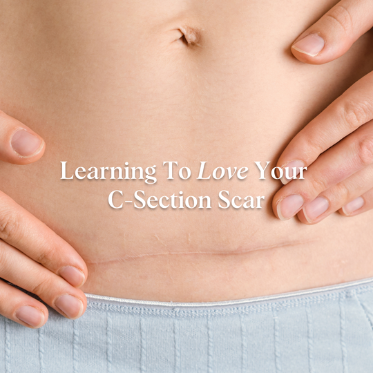 How To Perform A Scar Massage On Your C-Section Scar