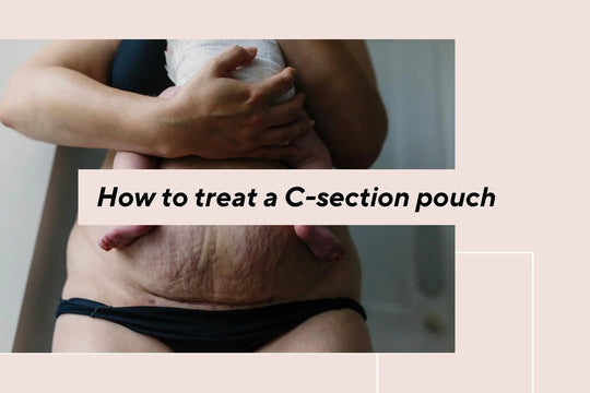 c section pouch treatment