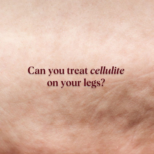 can you treat cellulite on your legs