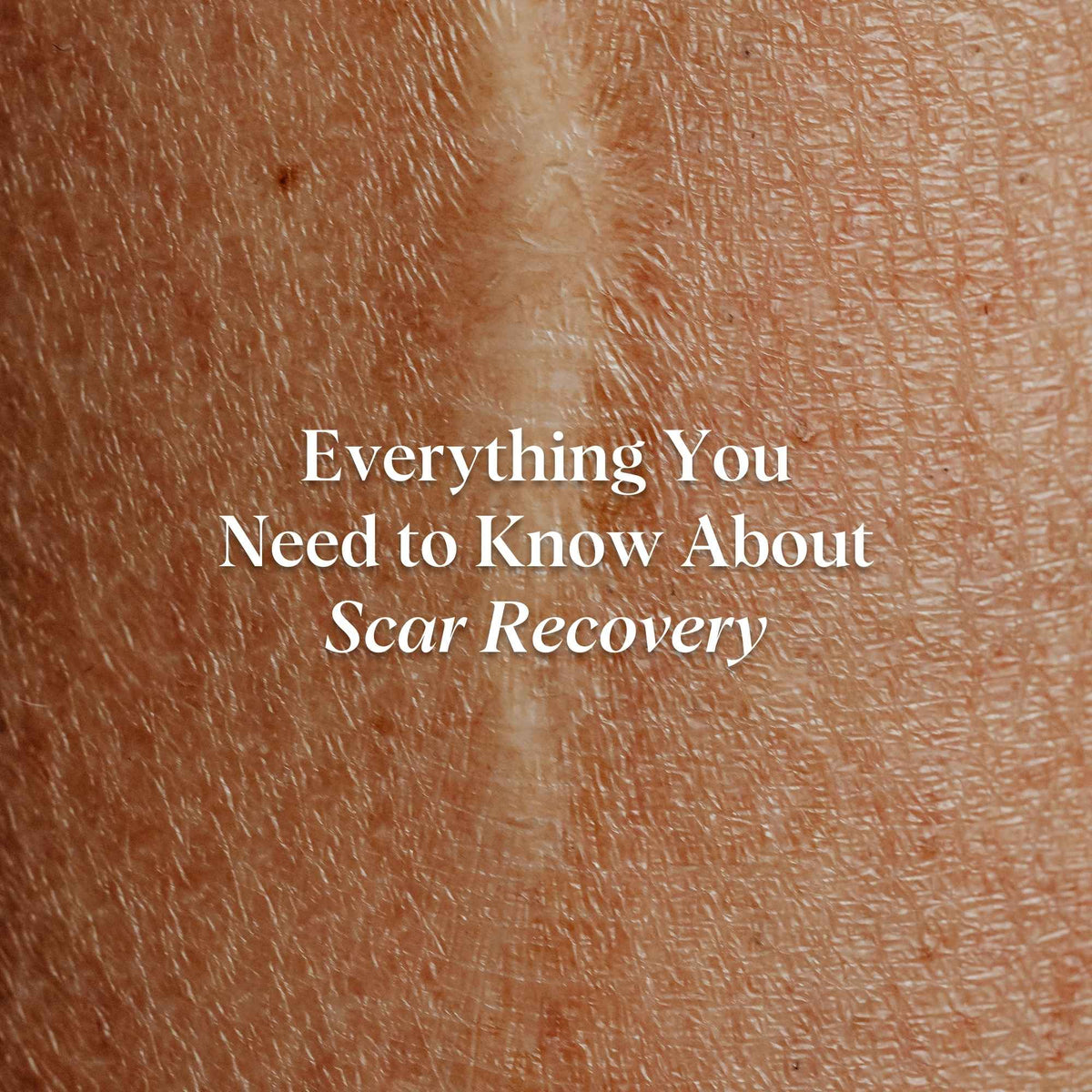 everything you need to know about scar recovery