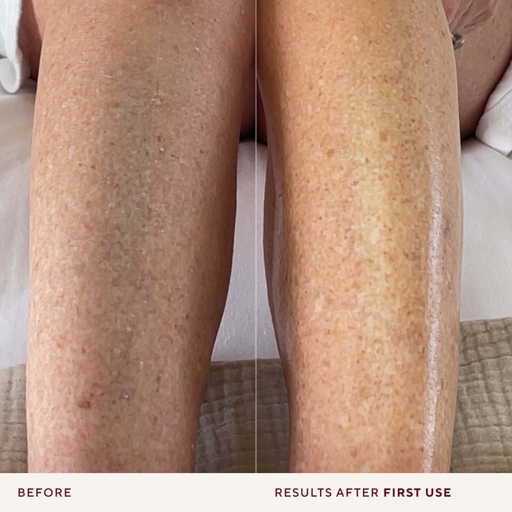 Before and after comparison of a person's legs showing a reduction in sun damage and hyperpigmentation from using Naydaya Body Blitz, with text reading 'BEFORE' and 'RESULTS AFTER FIRST USE' at the bottom.