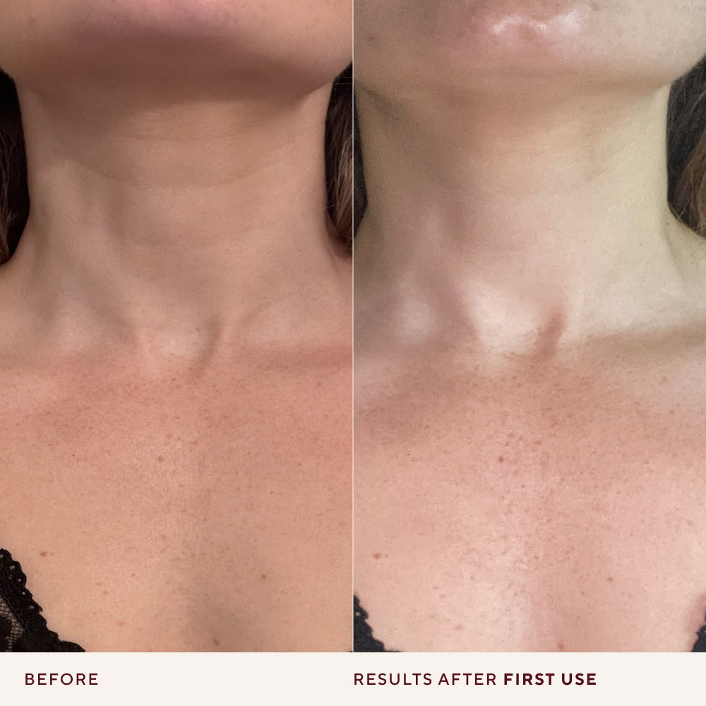 The Neck & Chest Shield Set
