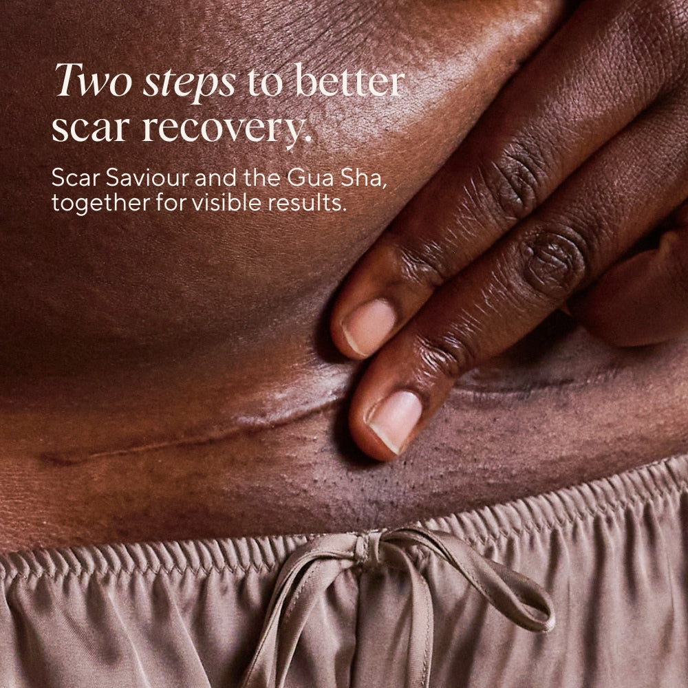 Scar Massage Bundle