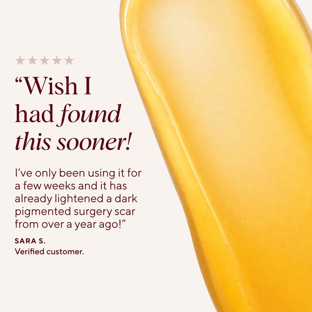 Scar Saviour Bundle - Scar & Stretch Mark Balm | NAYDAYA