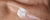 Dry skin